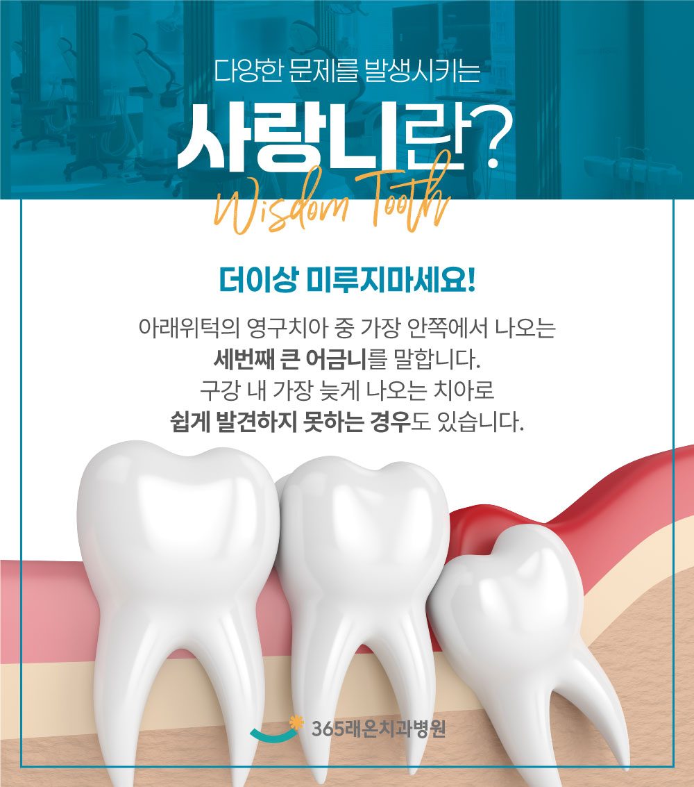 평택사랑니발치 안내 2