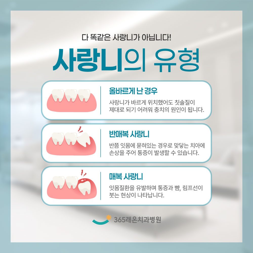 평택사랑니발치 평택사랑니발치 생각하고 있다면