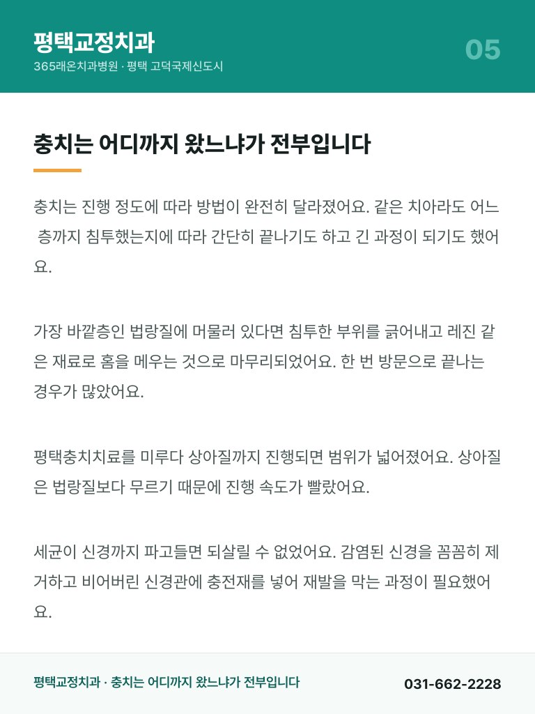 평택교정치과 - 5